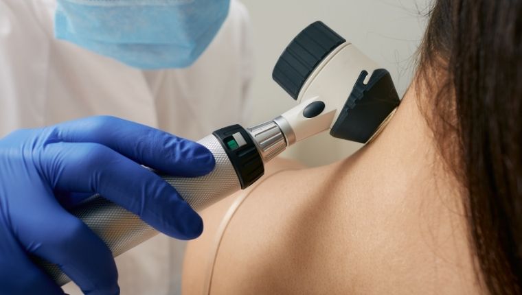 Dermatoskopi